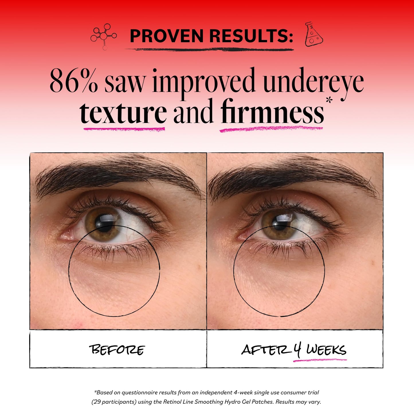 Derma E Retinol + Bakuchiol Under Eye Patches, Non-Irritating, Line Smoothing Hydro Gel Eye Patches with Rose Water & Real Hibiscus Petals, Helps Reduce Fine Lines, Crows Feet & Wrinkles